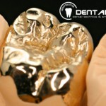 Herausnehmbarer Zahnersatz